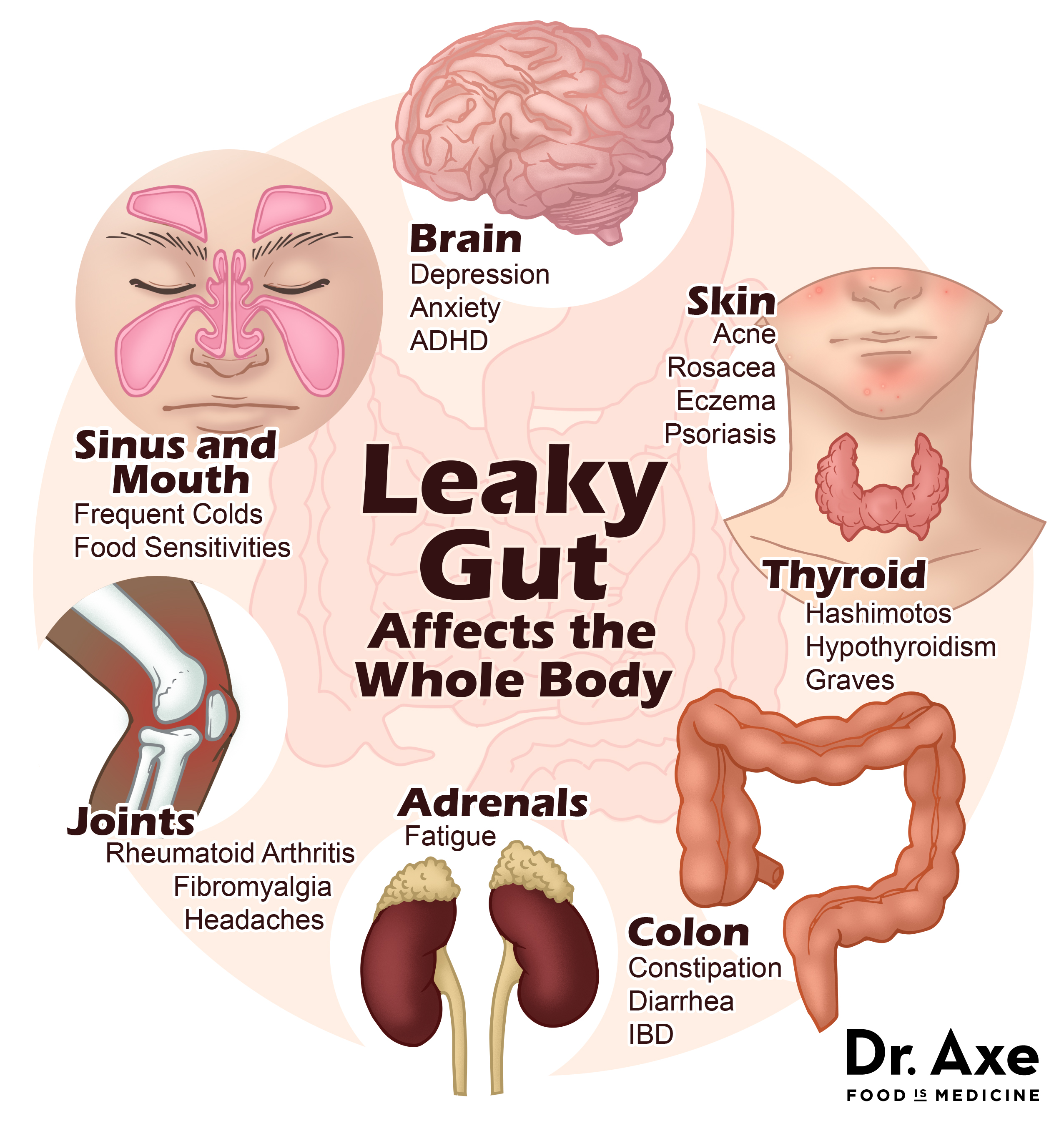 2 Leaky gut symptoms Axe